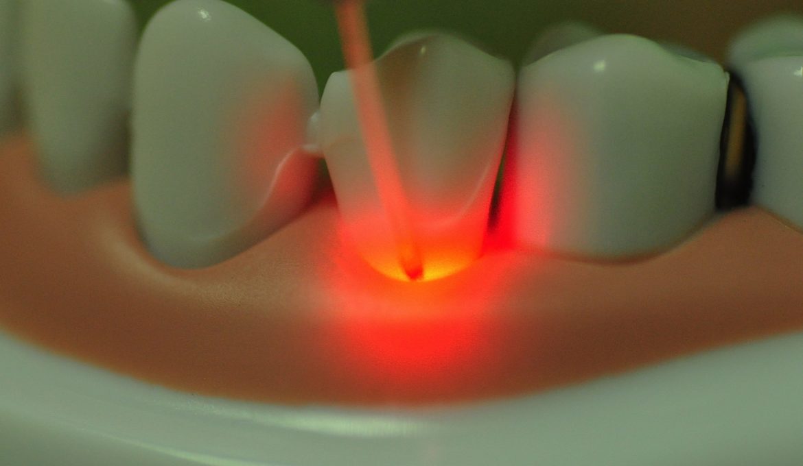 terapia laser dentista bologna