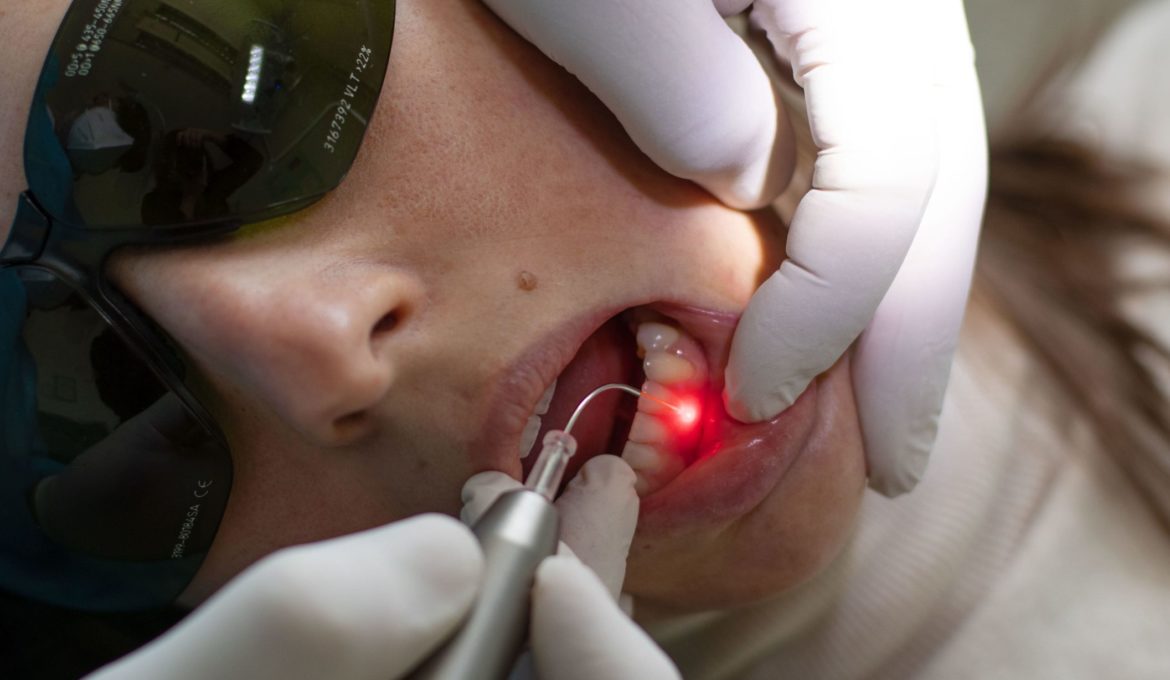 terapia laser dentista bologna