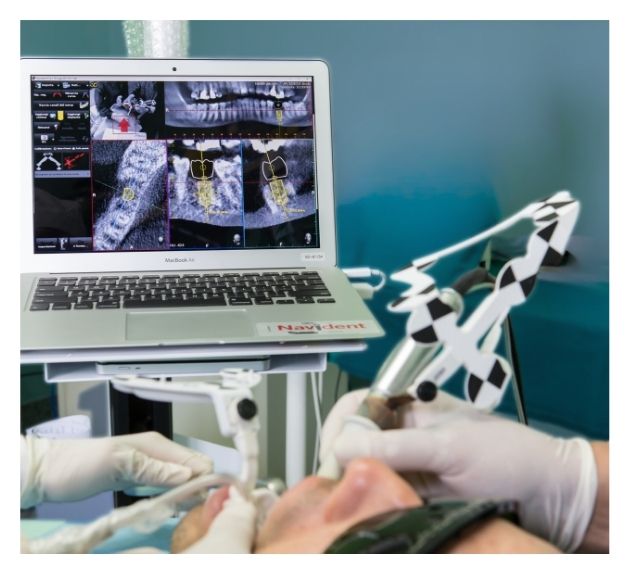 implantologia digitale bologna