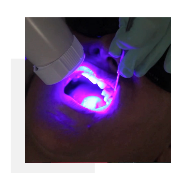 prevenzione tumori orali - dentista bologna