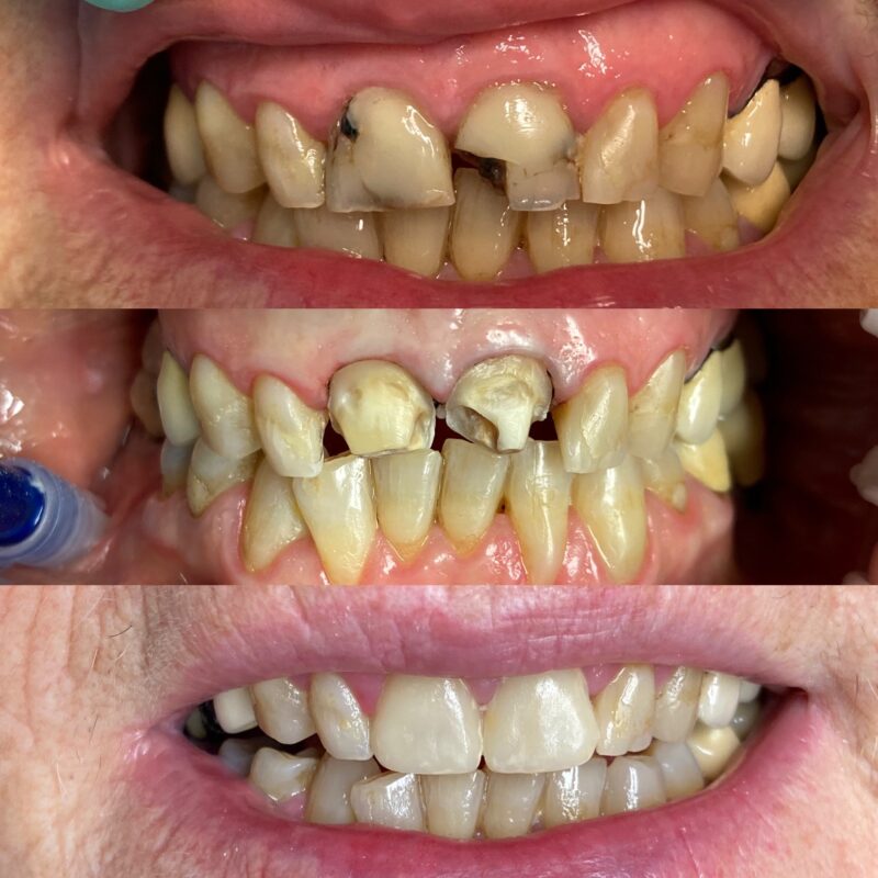 estetica del sorriso bologna