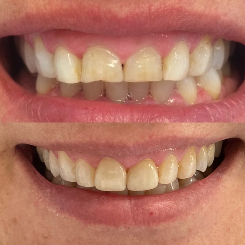 estetica del sorriso bologna