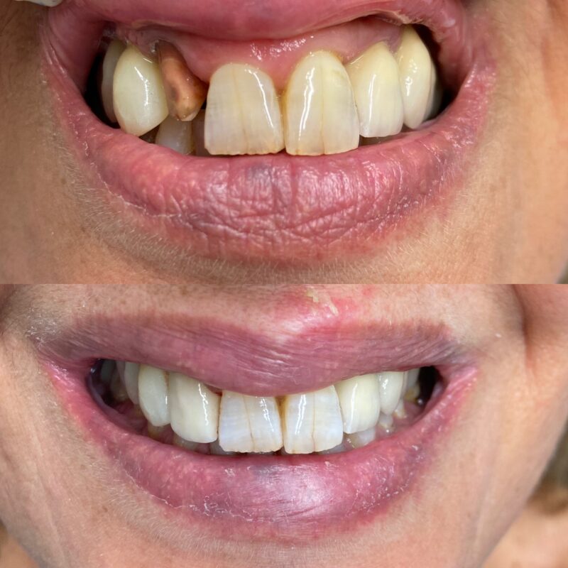 estetica del sorriso bologna