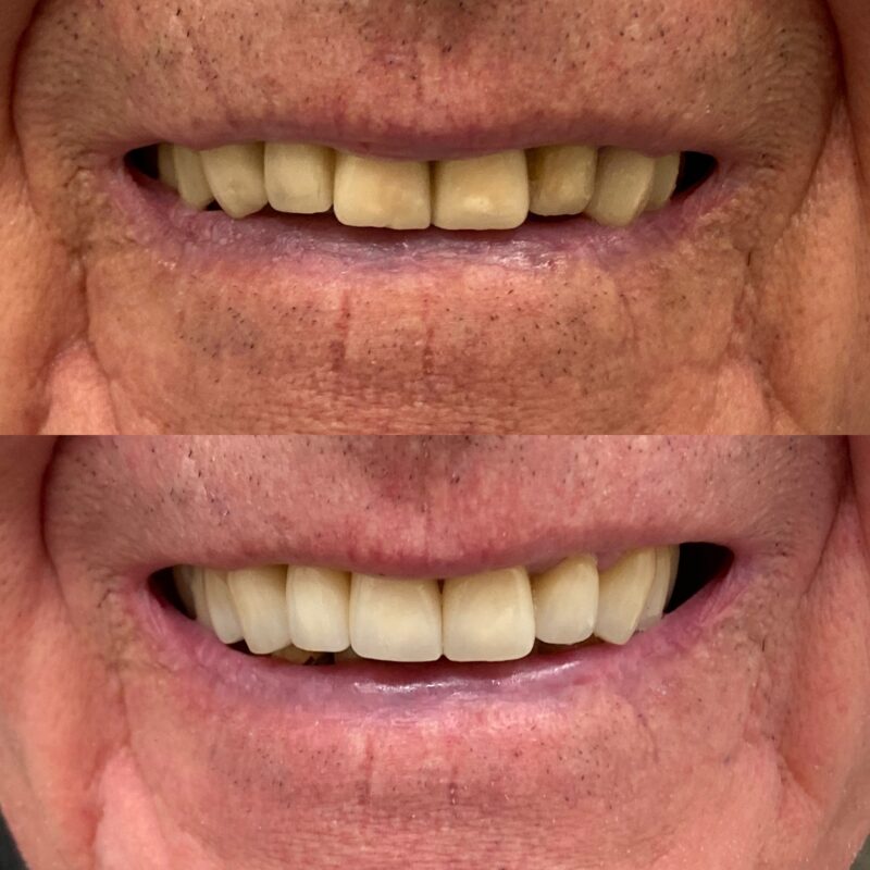 estetica del sorriso bologna