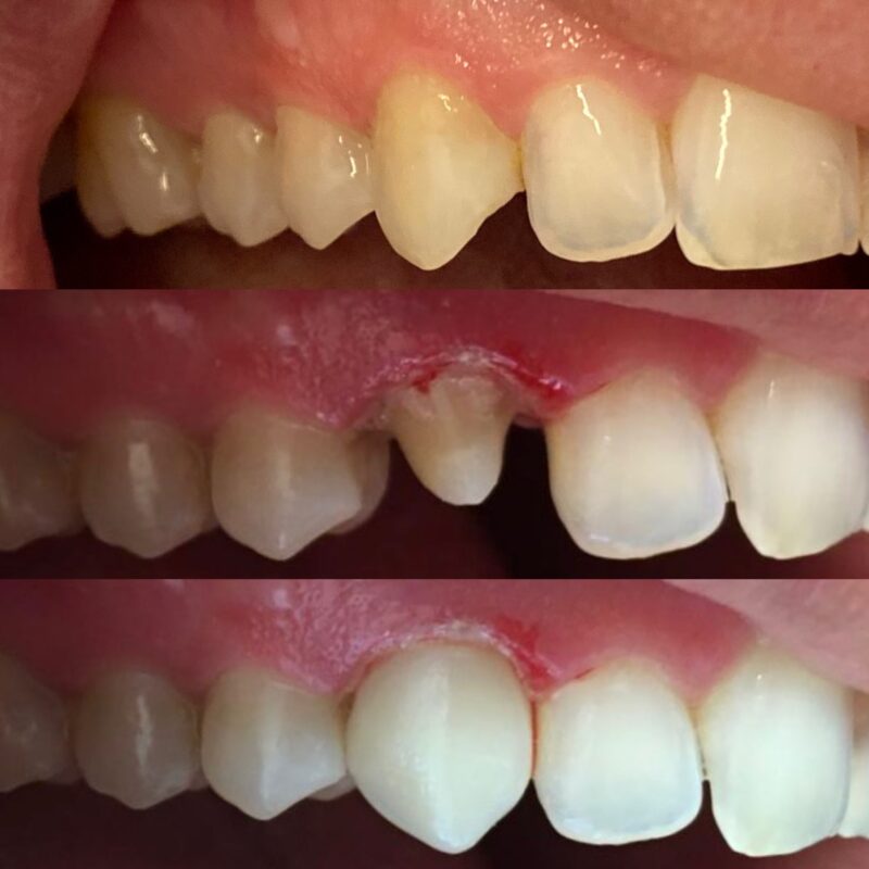 estetica del sorriso bologna