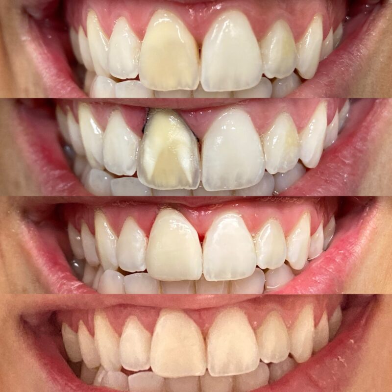 estetica del sorriso bologna