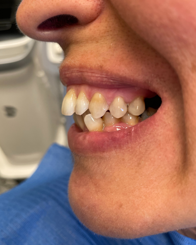 ortodonzia invisibile bologna (2)