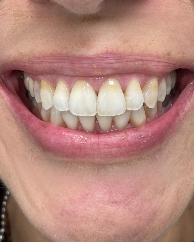 ortodonzia invisibile bologna marconi