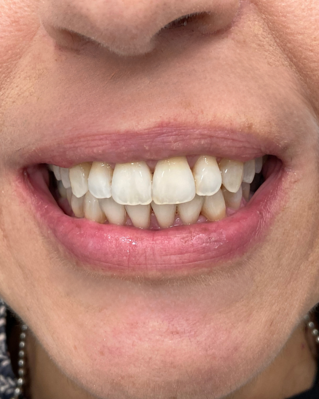 ortodonzia invisibile bologna marconi