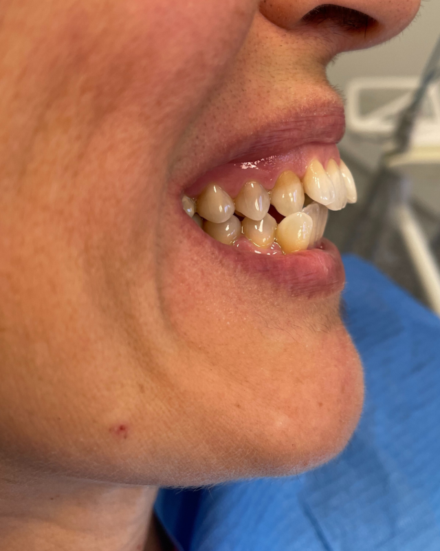 ortodonzia invisibile bologna marconi