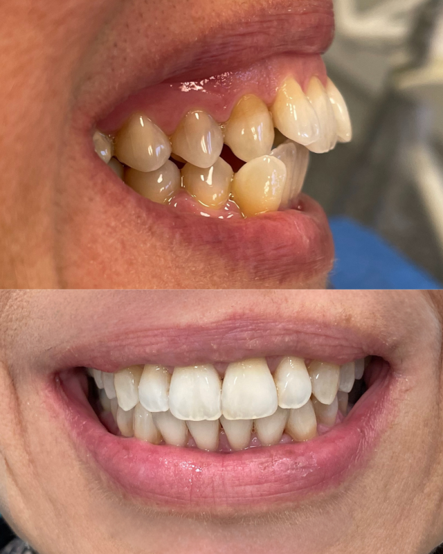 ortodonzia invisibile bologna marconi