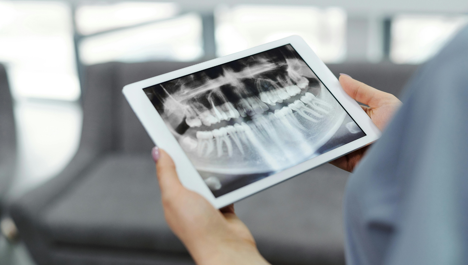 impianto dentale e parodontite bologna 2026 - dentista bologna